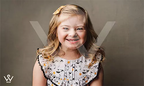 ردیاب برای مراقبت از کودکان سندروم داون